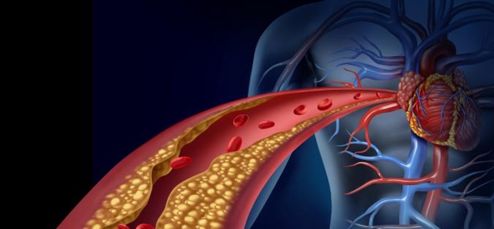 FWV 1-1-19 NanoCardio_2